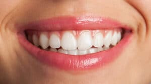 Dientes blancos y perfectos