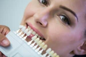 recomendaciones-en-el-blanqueamiento-dental
