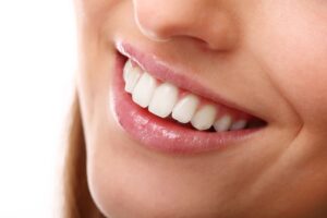 técnicas-de-blanqueamiento-dental