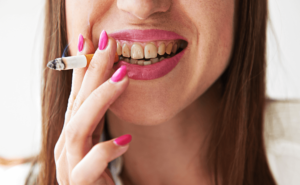 manchas de tabaco en los dientes