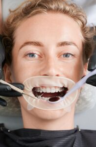 Protrusión dental