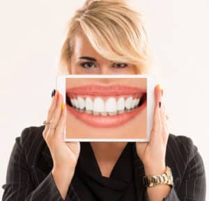 diseño de sonrisa