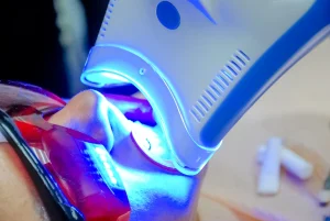 blanqueamiento y carillas dentales