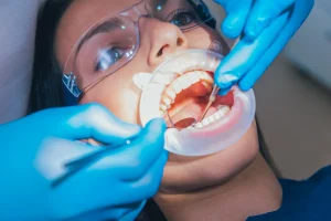 Endodoncia dental