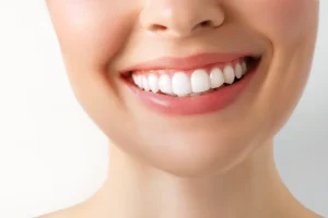 cómo se pone una carilla dental