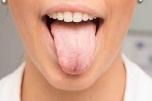 lengua blanca