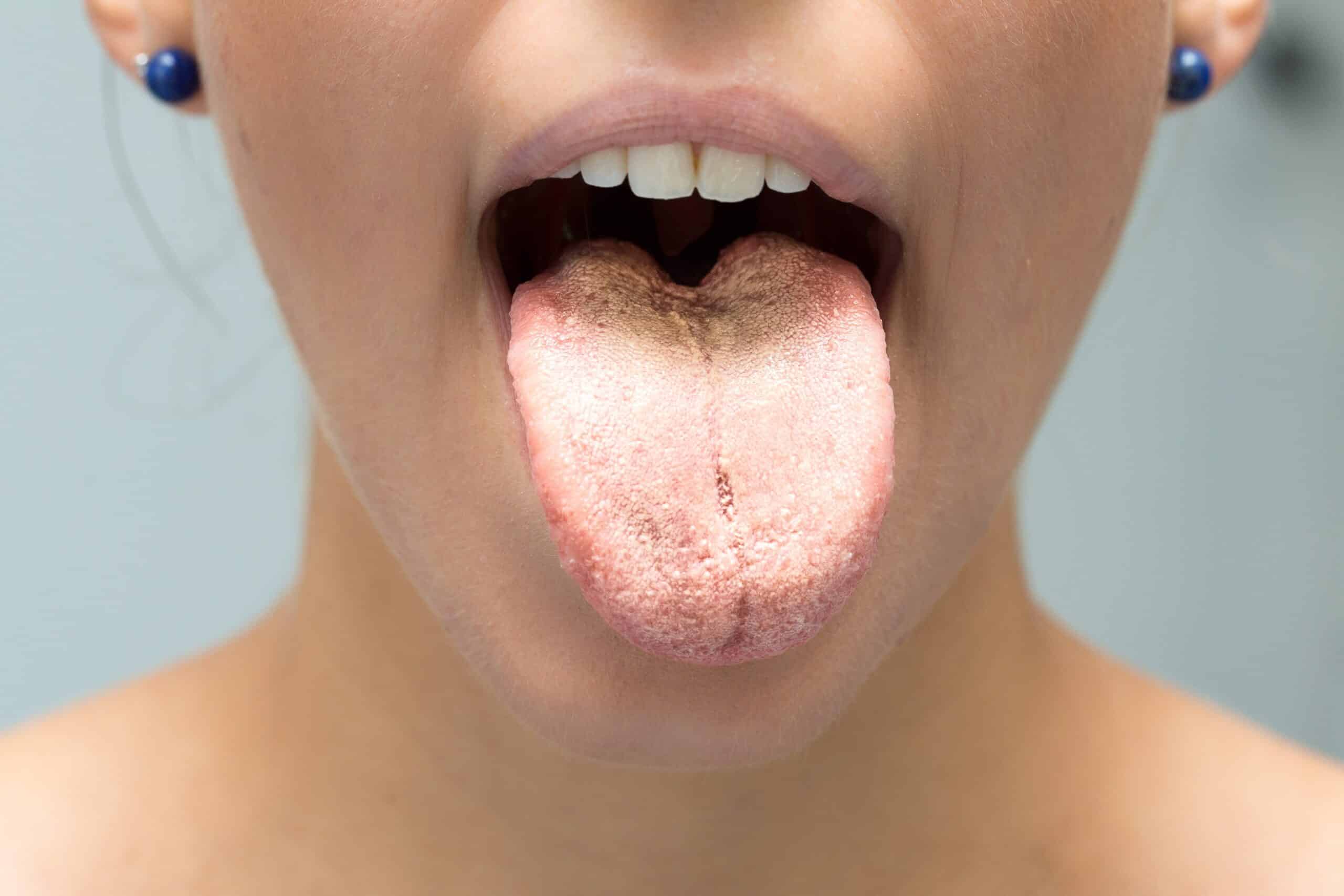lengua blanca | carlos saiz smile
