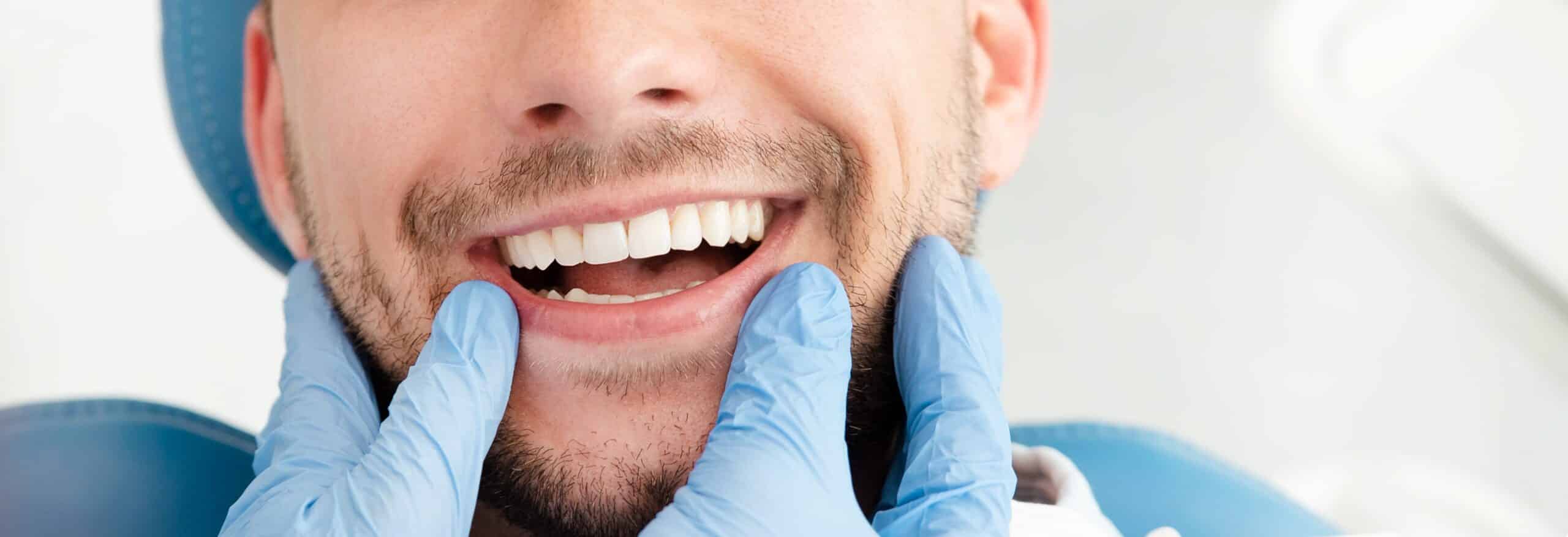 microcarillas dentales sin desgaste