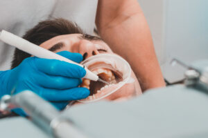 qué es curetaje dental