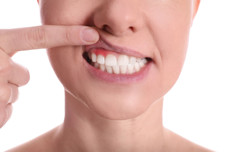 periodoncia