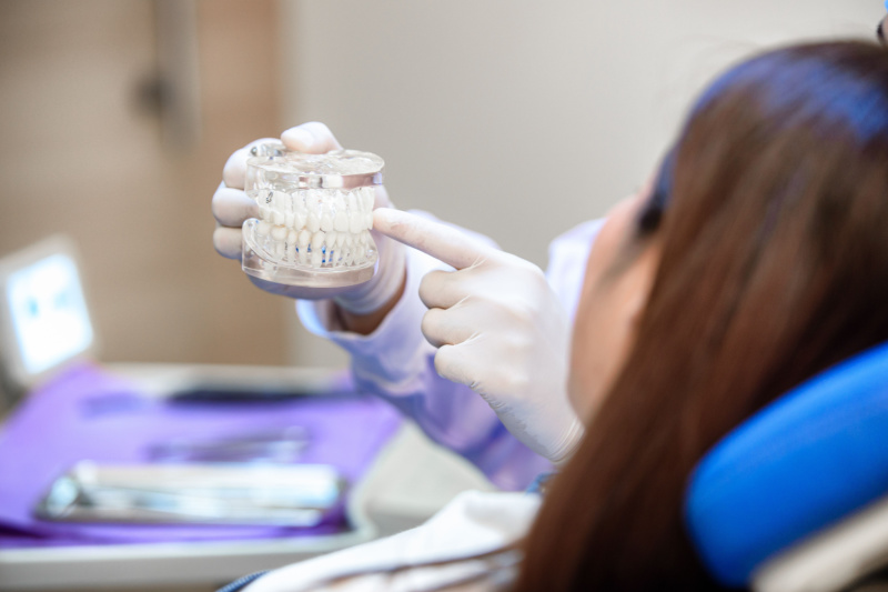 dental implant