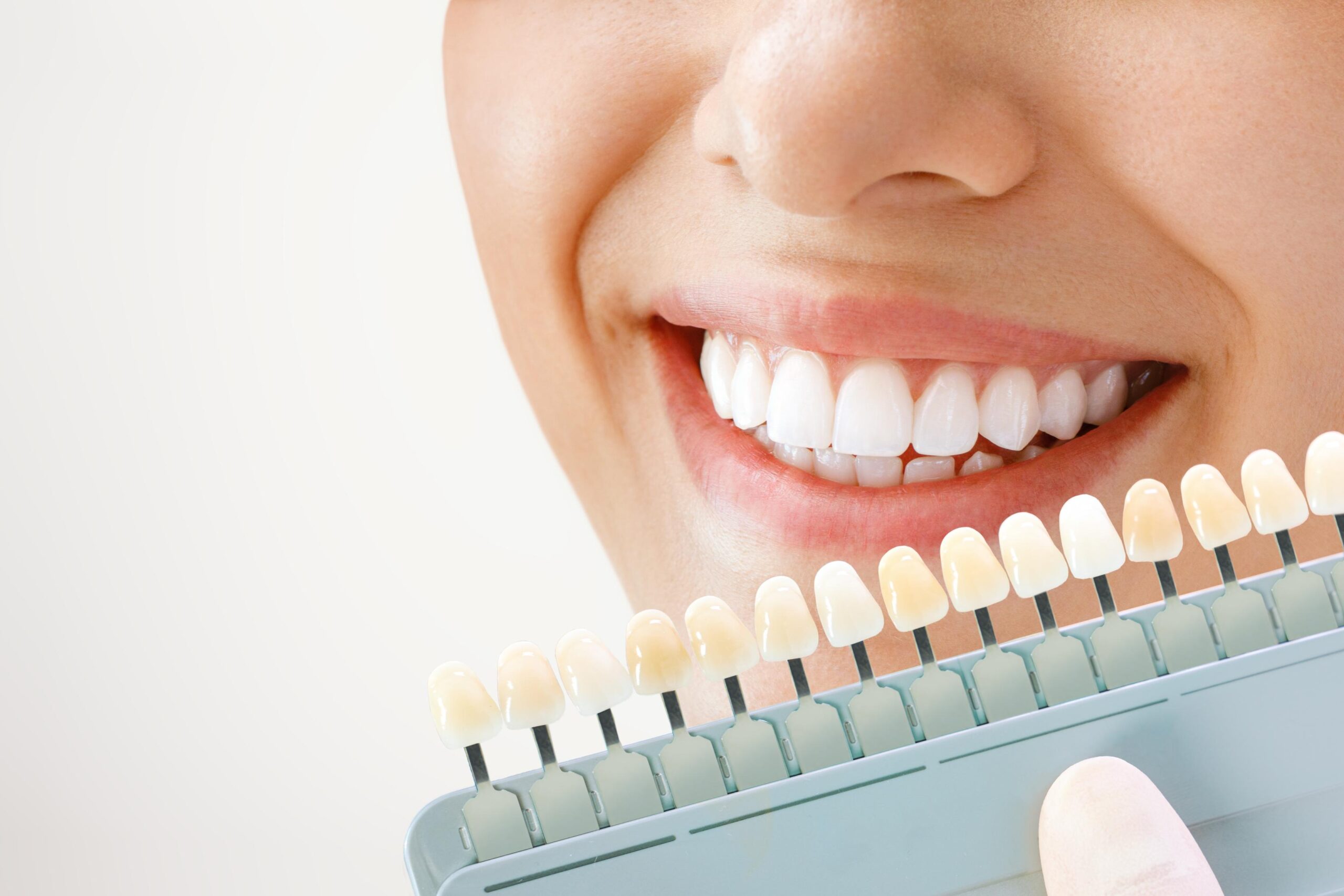 blanqueamiento dental riesgos
