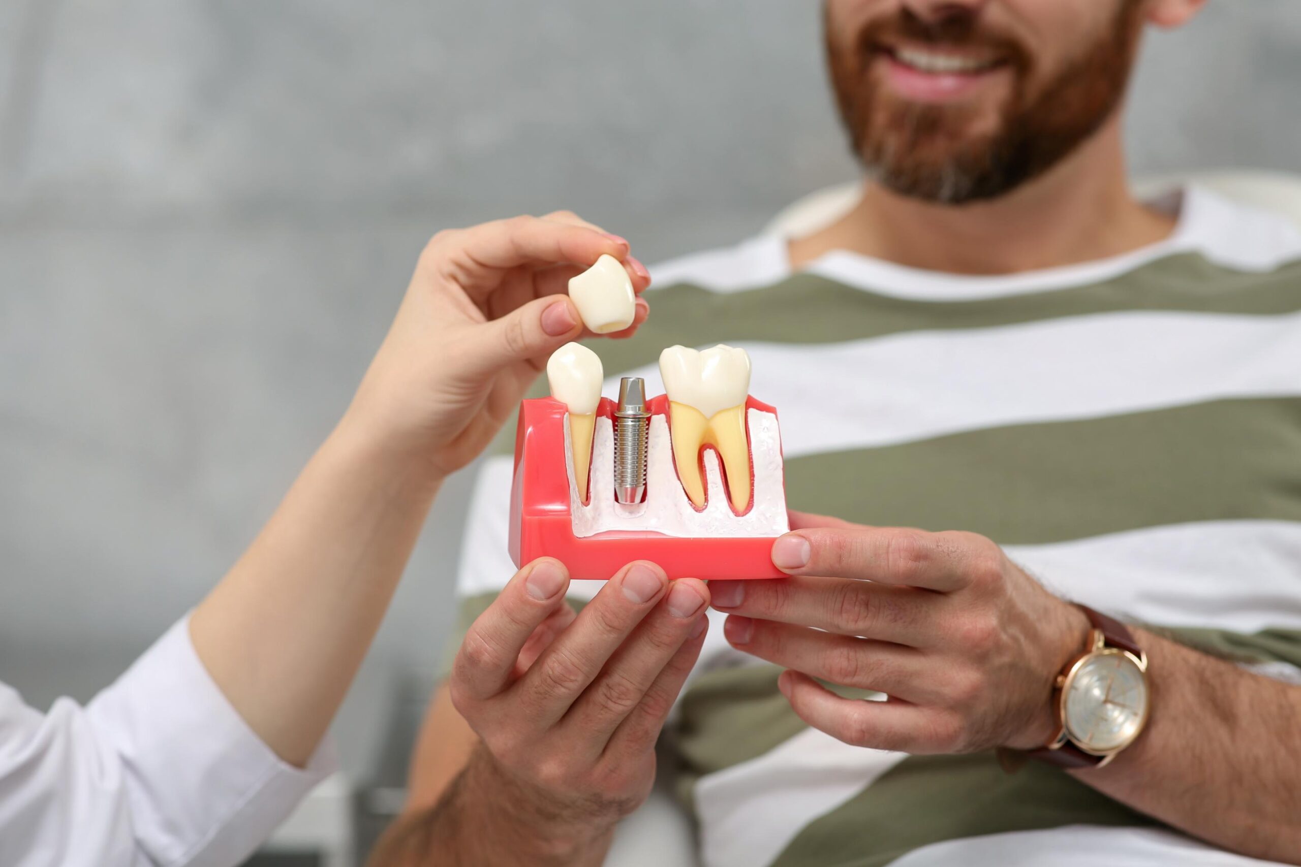 implantes dentales proceso