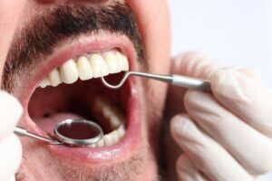 fundas dentales fijas
