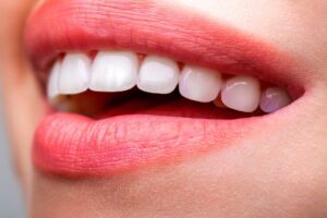 como tener unos dientes perfectos