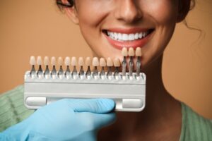 carillas dentales esteticas