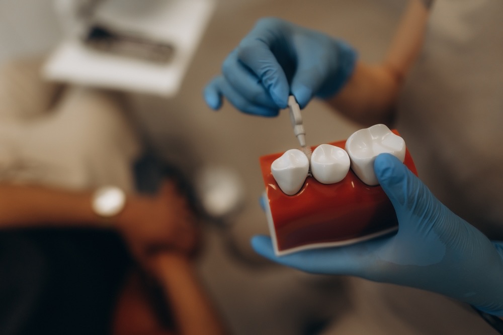 solución para un implante dental que se mueve