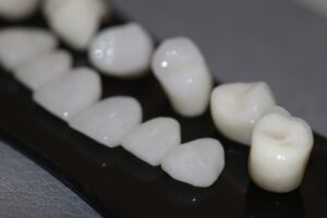carillas de zirconio