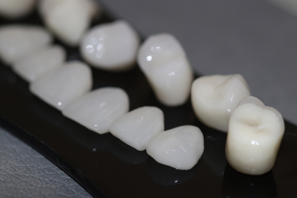 carillas de zirconio