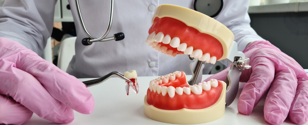 contorneado dental estetico