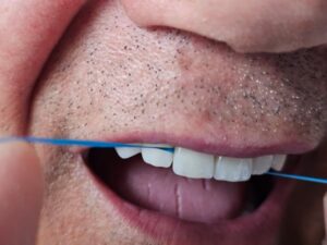 mantenimiento de carillas dentales