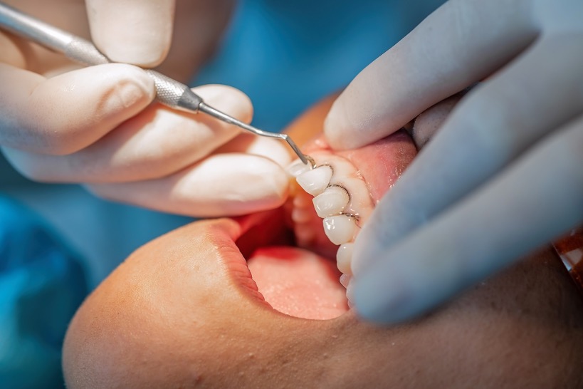 clinica estetica dental en mallorca