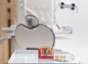 clinica estetica dental en madrid