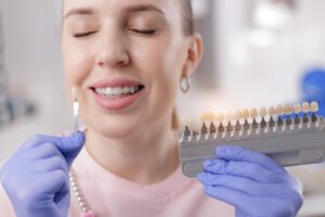 carillas dentales cuales son las mejores