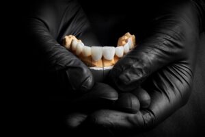 como quedan los dientes antes de las carillas