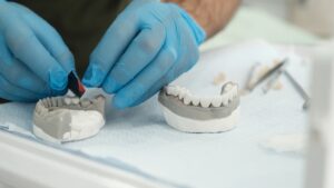 como quedan los dientes con carillas