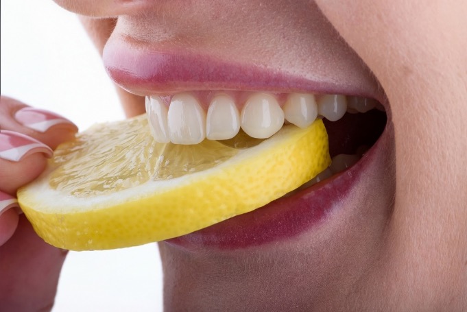 con las carillas dentales se puede comer