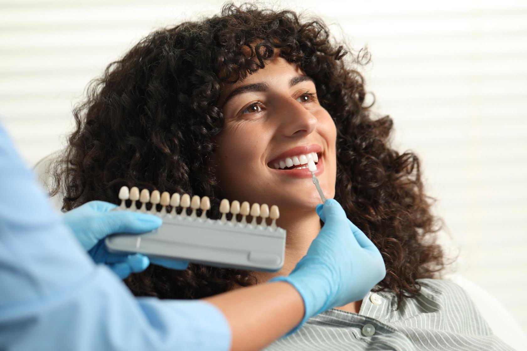 cuánto vale ponerse carillas en los dientes
