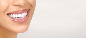 diseño de sonrisa alcala de henares