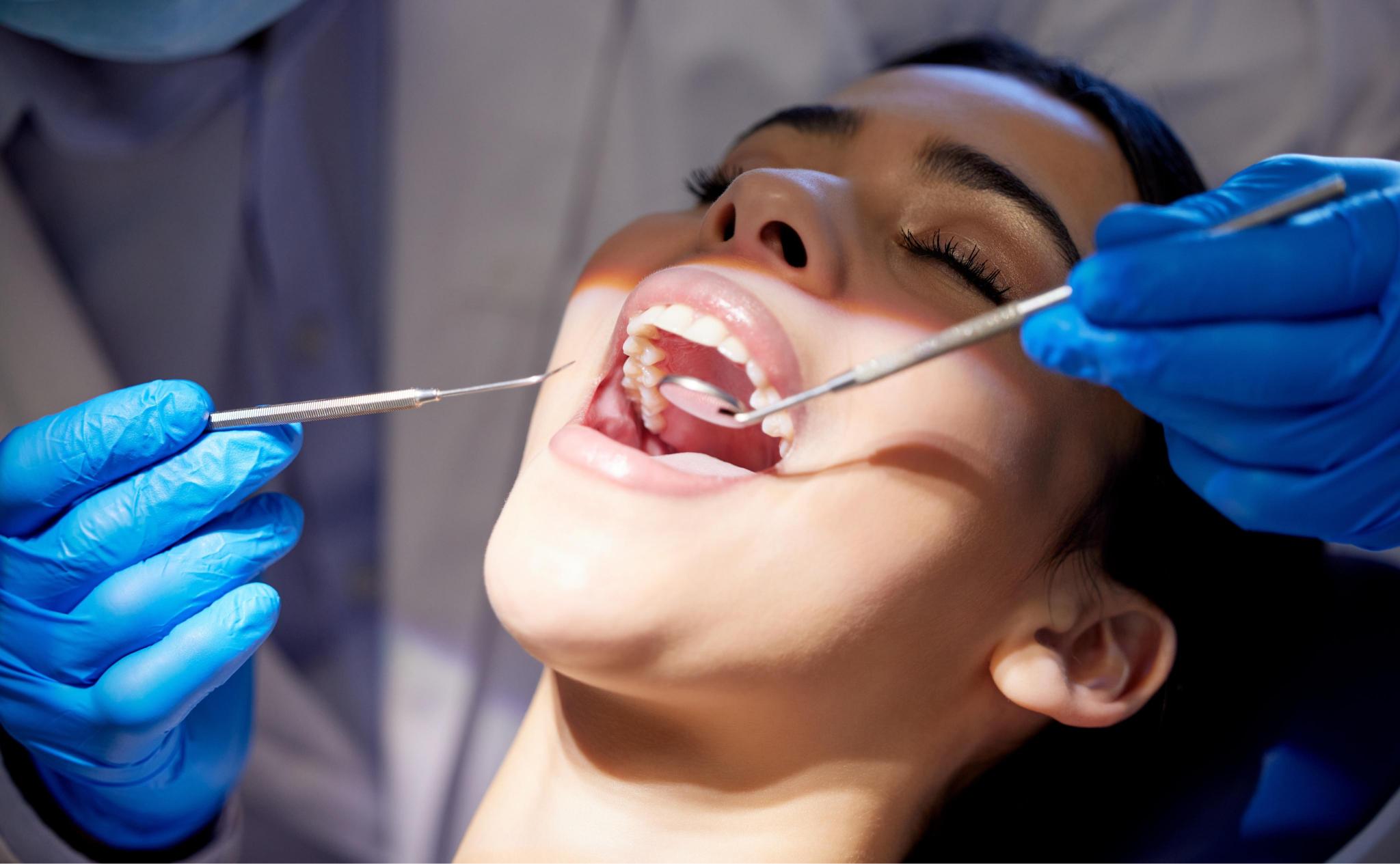 fundas para dientes rotos