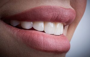 mejorar la apariencia de los dientes