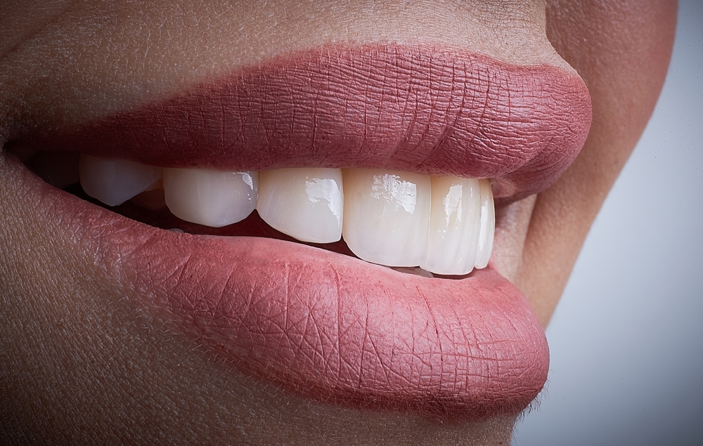 mejorar la apariencia de los dientes