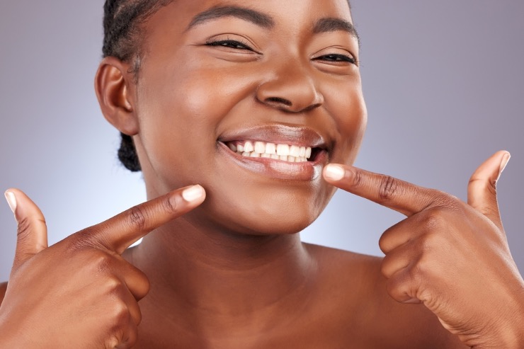 carillas dentales color natural