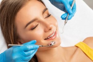 carillas esteticas dentales