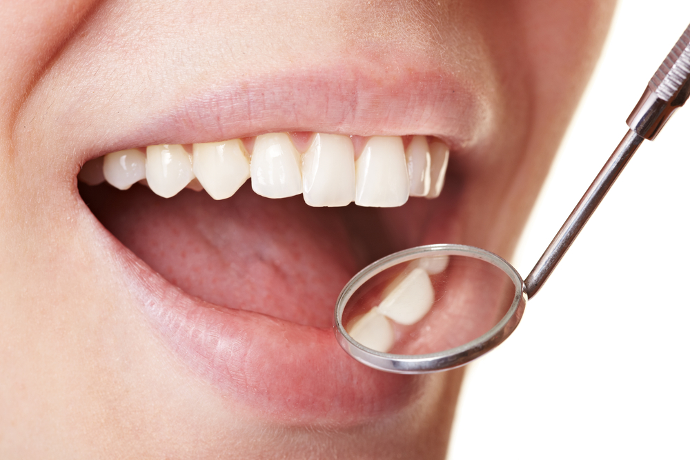 Arreglar dientes sin limarlos