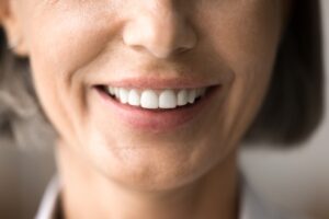 por qué mi sonrisa se ve rara en fotos