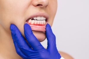 cómo calmar el dolor de encías y cuándo acudir al dentista