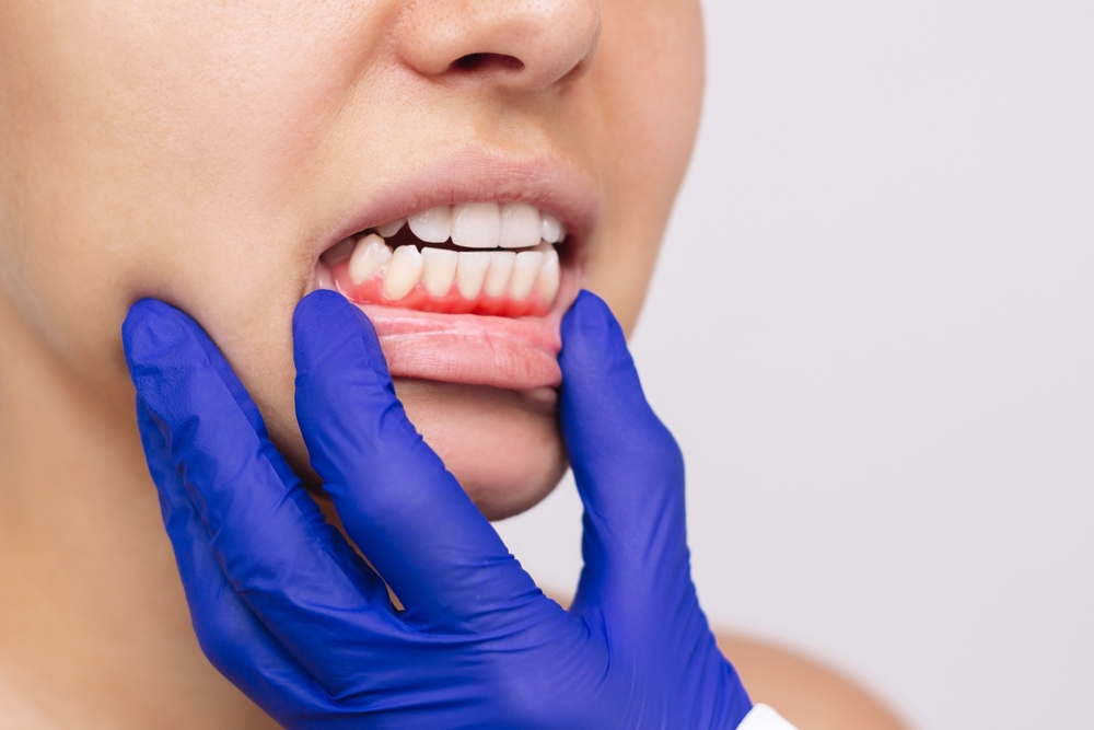 cómo calmar el dolor de encías y cuándo acudir al dentista