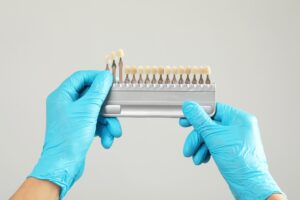 cómo elegir una buena clínica para carillas dentales