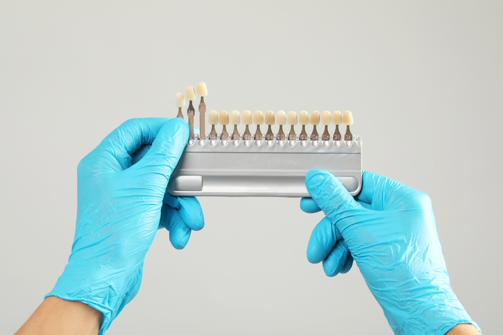 cómo elegir una buena clínica para carillas dentales