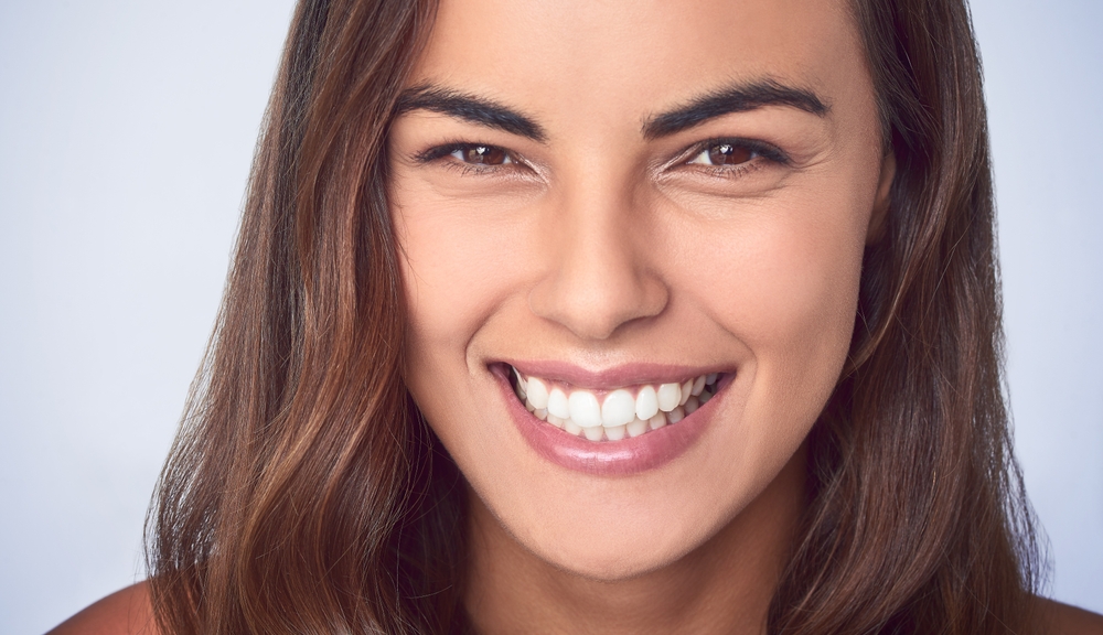 carillas dentales y blanqueamiento