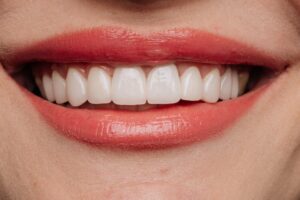 diseño de sonrisa en España