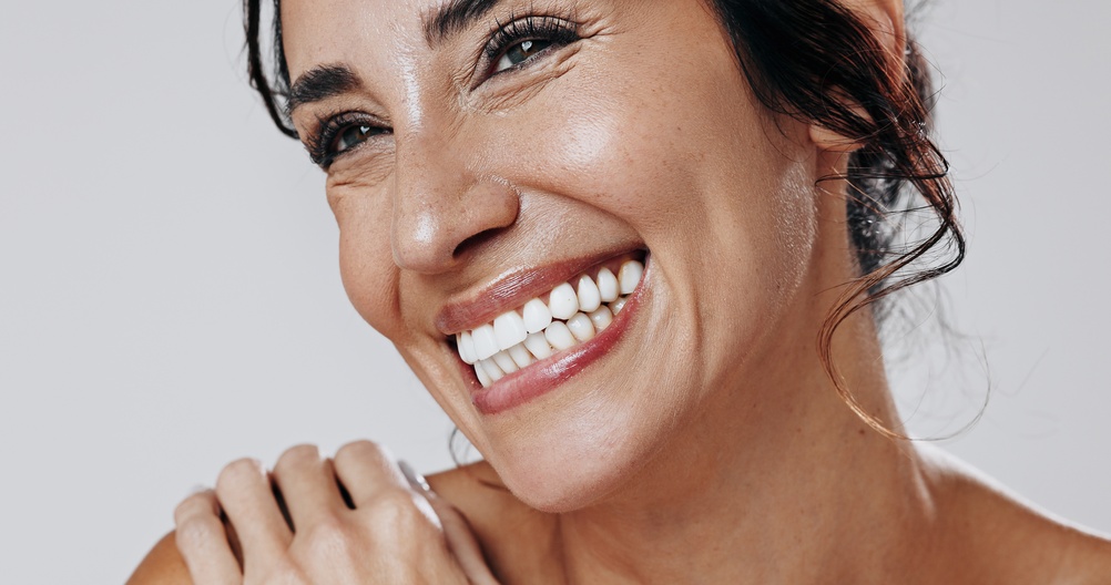 mejorar la sonrisa