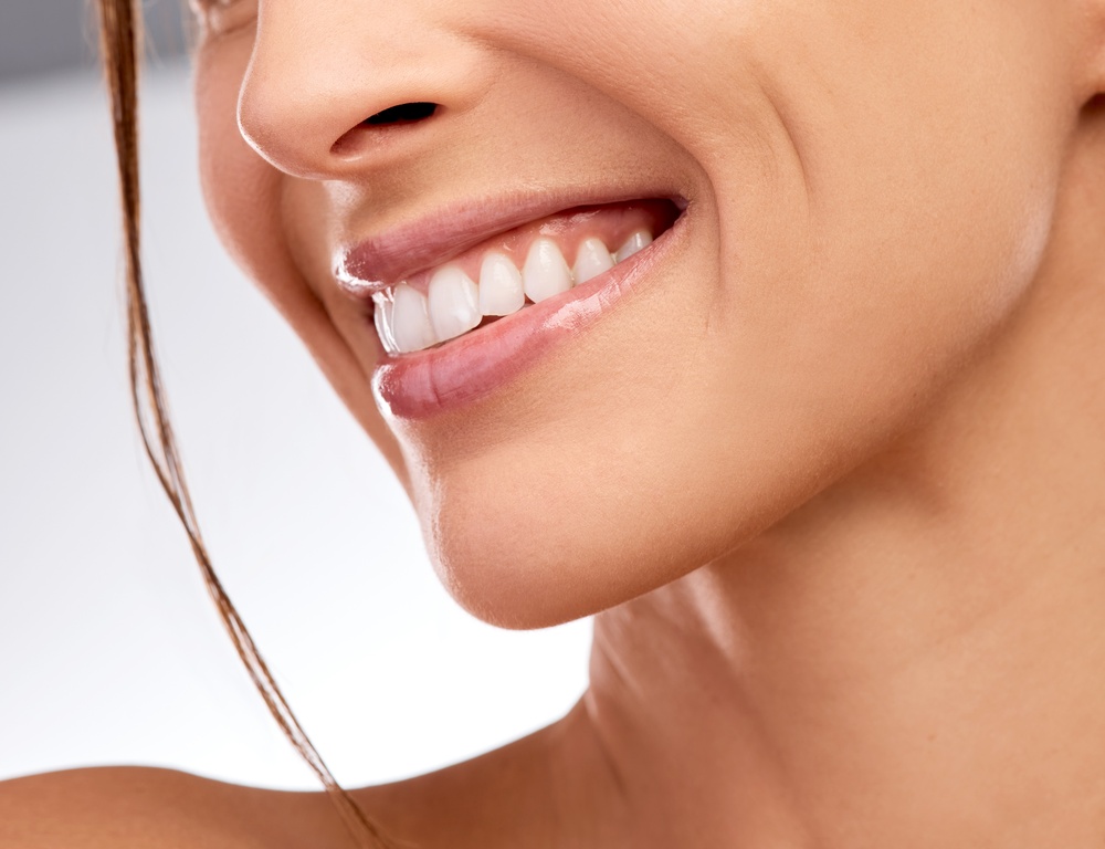 estética dental