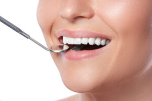 carilla dental