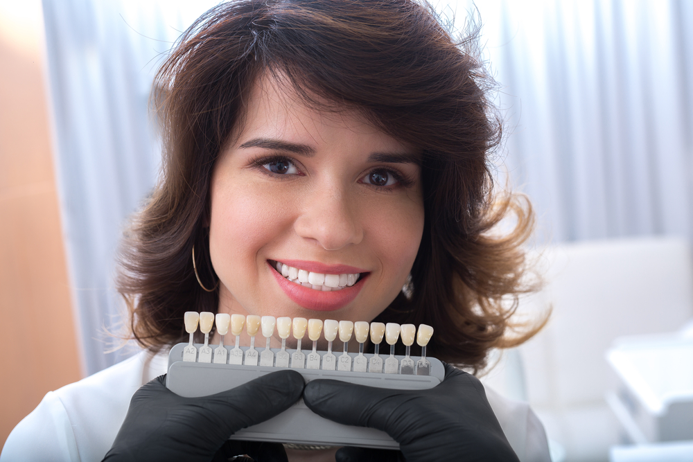 sonrisa con carillas